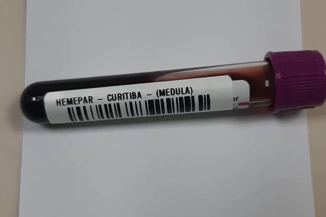 Fevereiro Laranja: mês da conscientização sobre leucemia reforça importância do diagnóstico