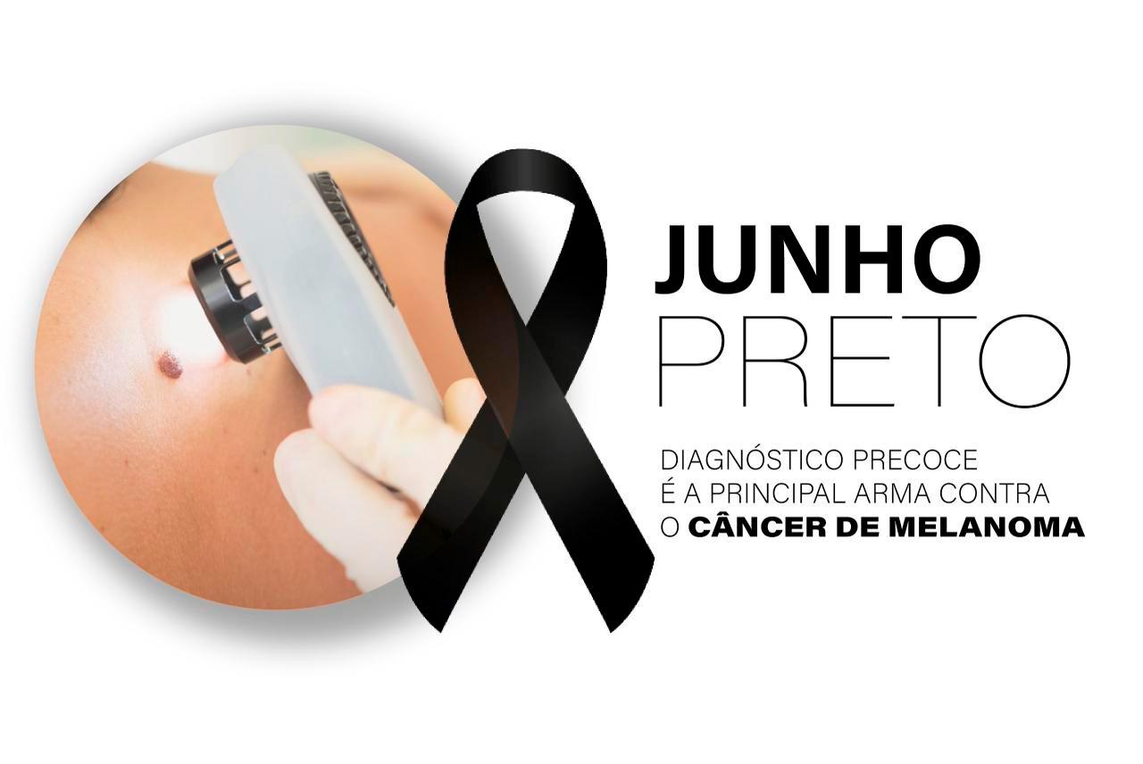 Diagnóstico precoce é a principal arma contra o melanoma, tipo mais agressivo de câncer de pele